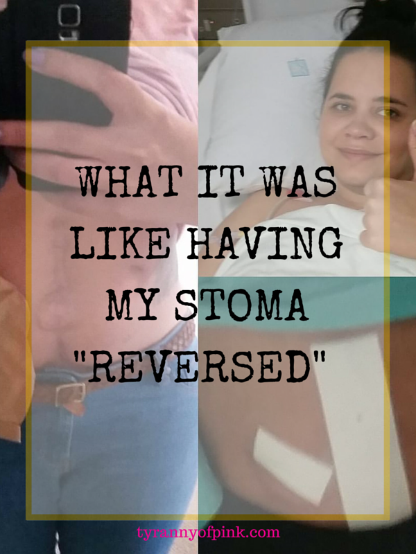 What it was like having my stoma -reversed- - Tyranny of Pink